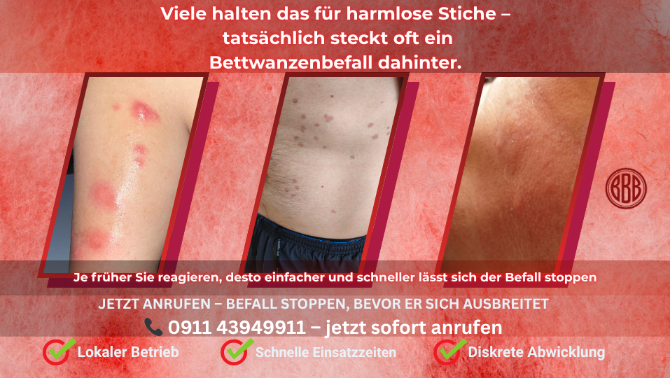 Bettwanzenstiche erkennen – typische Anzeichen eines Befalls Bettwanzenstiche auf der Haut – typische Symptome eines Bettwanzenbefalls in Fürth